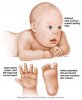 5ad507b10108890f0f82c08dc89f2b66--down-syndrome-baby-risk-of-down-syndrome.jpg