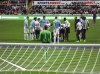NUFC v Man City  30th Oct 028  Dzeko Itch.jpg