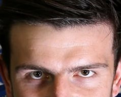 Harry Maguire's Forehead